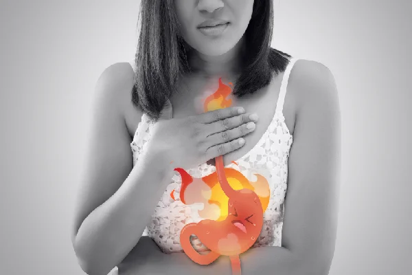 Acid Reflux